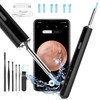 Qimic Ear Wax Removal, Ear Cleaner with Camera and Light,