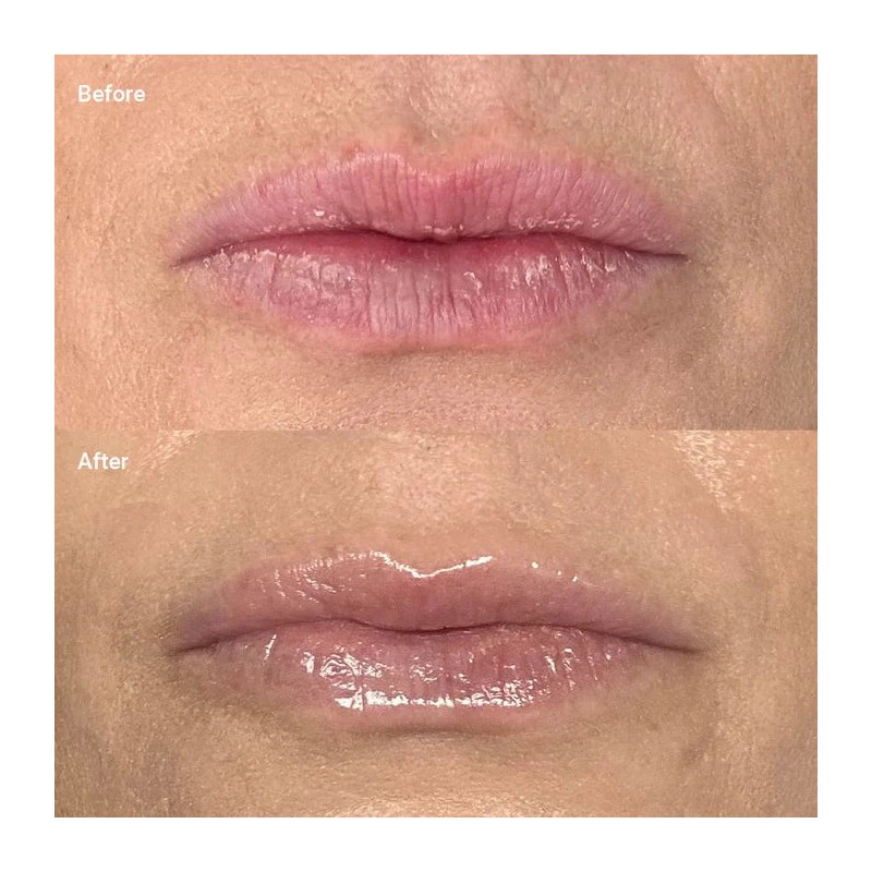 Cinch Minty Glow Lip Balm 15g