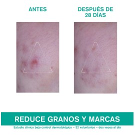 Uriage Hyseac 3-regul Cuidado Anti-imperfecciones 40ml