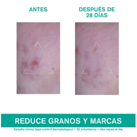 Uriage Hyseac 3-regul Cuidado Anti-imperfecciones 40ml