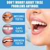 Temporary Tooth Filling Kit,Temporary Tooth Repair Kits,Moldable False Teeth Replacement,False