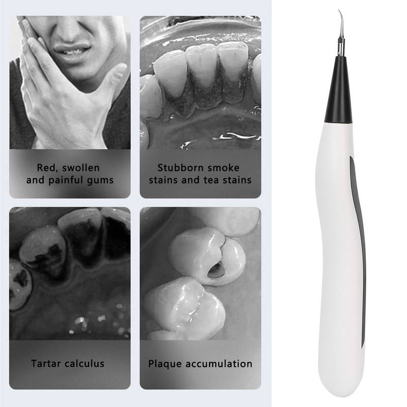 Electric Dental Calculus Remover Portable Oral Calculus Remover Teeth Cleaning