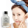 Chamos Trouble magic powder soothing serum sebum spot care allantoin
