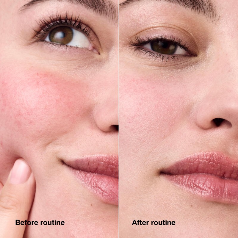 Clinique Redness Solutions Daily Relief Cream with Microbiome Technology, 1.7