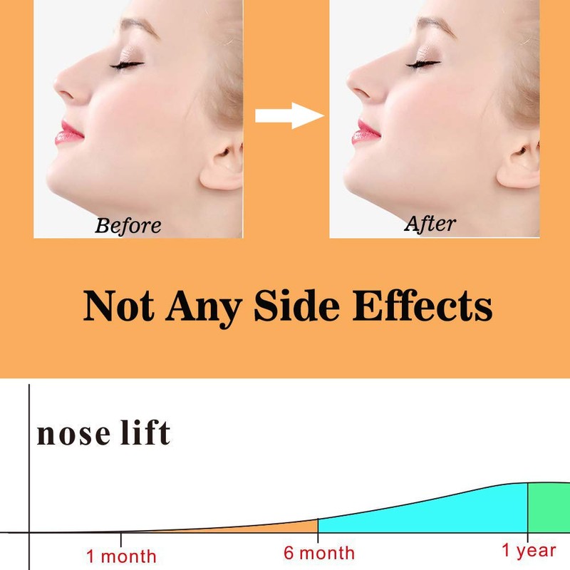 AMIJEAL Nose Shaper Clip - Up Lifting Clip, Pain-Free Soft