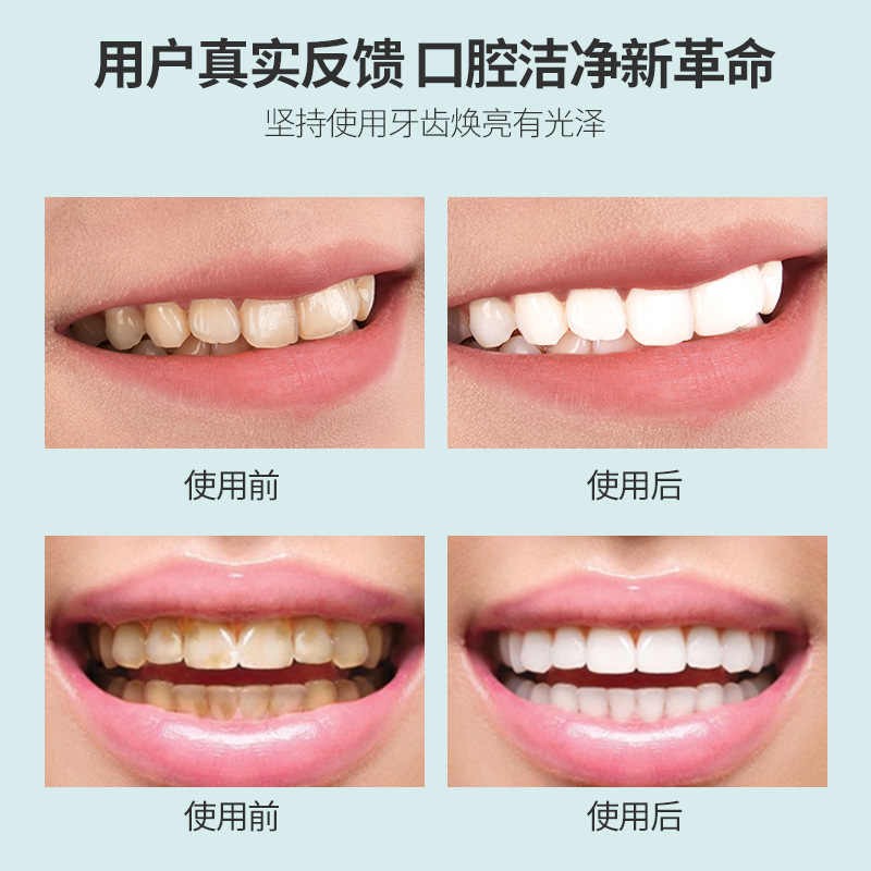 Xiangmei probiotic tooth whitening powder, tooth stains, yellow tooth calculus,