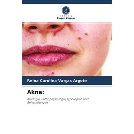 Akne:: Ätiologie, Pathophysiologie, Typologien und Behandlungen