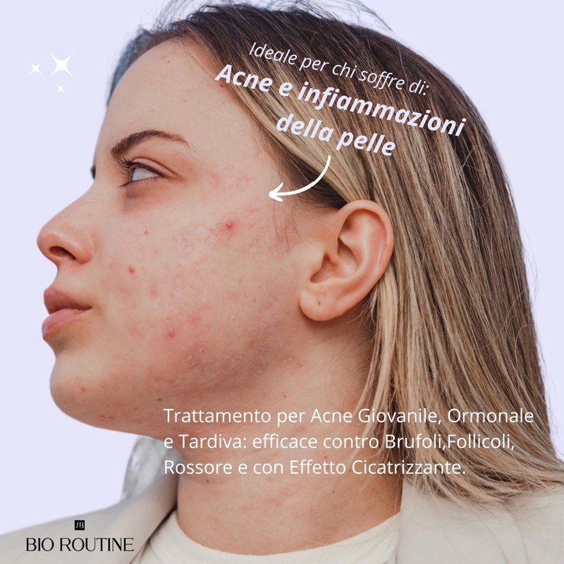 Bio Routine AcnePro Active, Akne-Creme für das Gesicht, entfernt Akne,