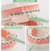 Lakeyface 150 Count Orthodontic Flossers for Braces with Floss Dispenser,