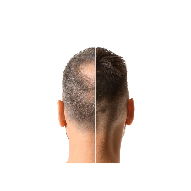 RESTRAND Hair Building Fibres. The Latest Generation of Fibres. Instantly