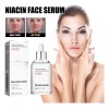 Niacina Suero Facial Desvanece Marcas De Acné Hidratación