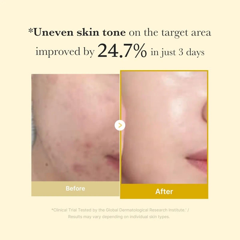 Medicube Kojic Acid Turmeric Night Wrapping Mask 75ml Todo Tipo