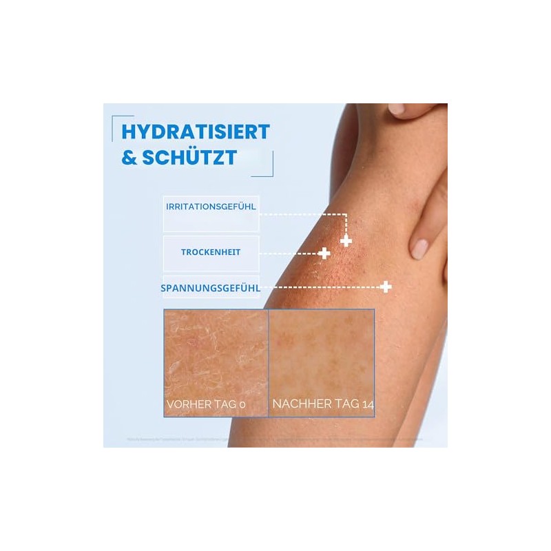 Mixa Ceramide Protect Body Cream 400ml Dermoprotector