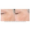 NEOSTRATA Skin Active Tri-Therapy Lifting Serum 30mL
