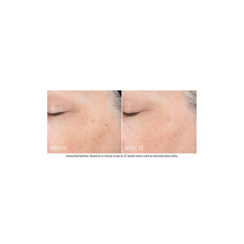 NEOSTRATA Skin Active Tri-Therapy Lifting Serum 30mL
