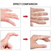 FunnAura 12PCS Finger Splints for Arthritis Kit, Trigger Thumb Splint