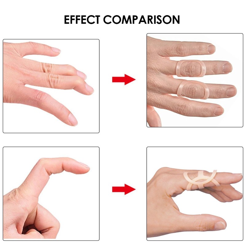 FunnAura 12PCS Finger Splints for Arthritis Kit, Trigger Thumb Splint