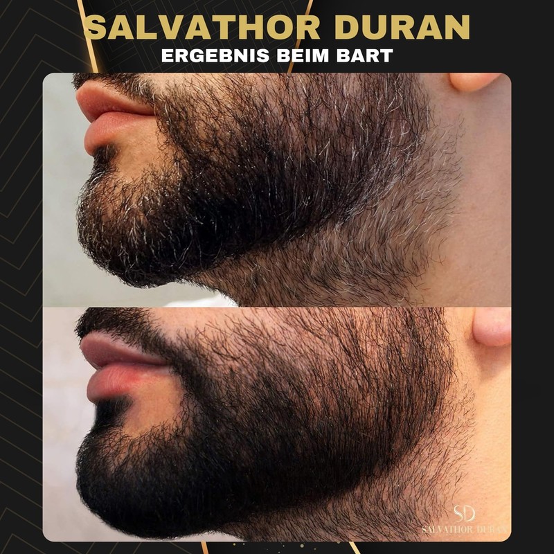 Beard Dyeing Men - Beard Colour Black - Beard Dye