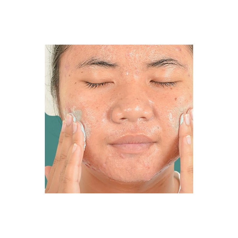 Exfoliante para el acné, sin aceites de Neutrogena Power-clear, control