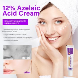 Azelaic Acid 12%, High Concentration of Salicylic Acid, Moisturizing, Suitable for Rough, Oily, And Sensitive Skin, Controls Oil (Shrinks Pores, And Reduces Shine Skin Care)
