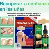 Parches Antimicóticos For El Tratamiento De Uñas