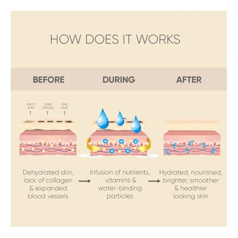 Parches Para Usar Debajo De Los Ojos (80 Pares) Célor