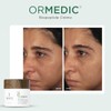 Image Crema biopéptido equilibrante Ormedic de Image para unisex -