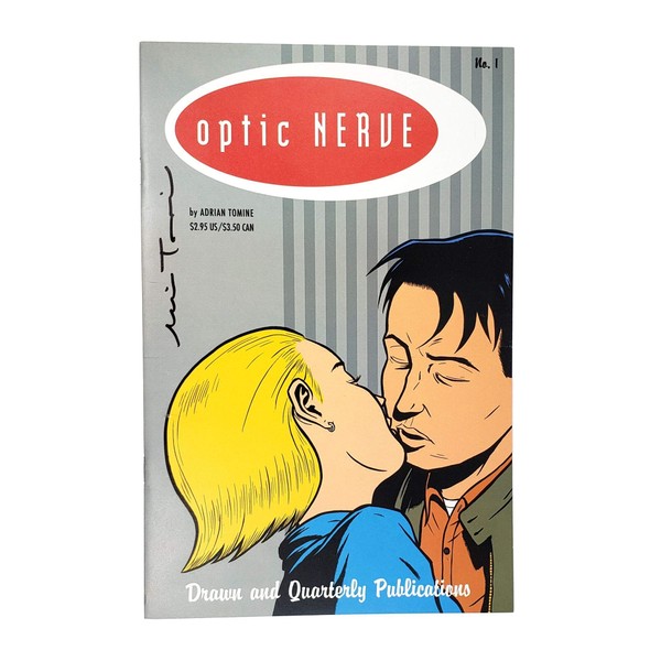 Optic Nerve #1 and #2