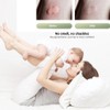 Electric Anti Itch Device Anti Mosquito Bite Against Itching Stick