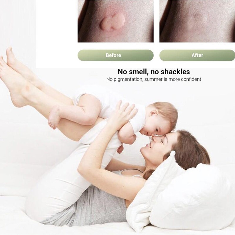 Electric Anti Itch Device Anti Mosquito Bite Against Itching Stick