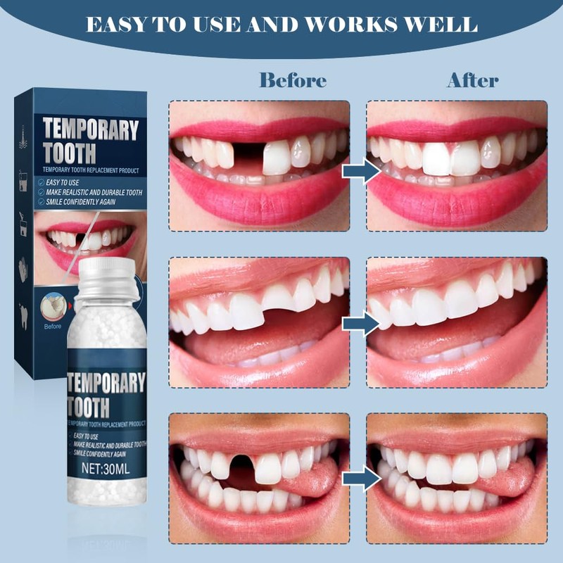 Temporary Tooth Set, Tooth Repair Kit, Temporary Teeth Replacement Kit