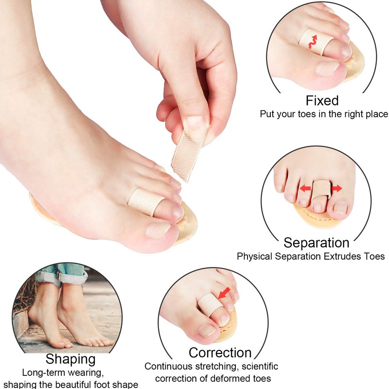 BBTO 4 Pcs Budin Toe Splint Hammer Toe Straightener Support