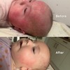 Salcura, Bioskin Junior Outbreak Rescue Cream, Packed With Natural Ingredients,