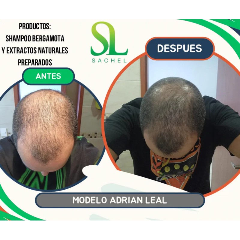 Shampoo Bergamota + Shampoo Romero + Bergamota Aceite 15ml