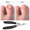 Toe Nail Clippers for Thinck & Ingrown Nails,Stainless Steel Toenails