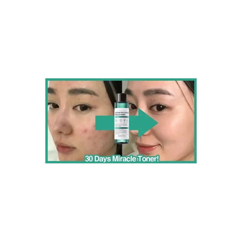 Loción 30 Days Miracle Toner Some by Mi de 150mL