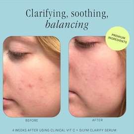 Brandefy Vitamin C + Silym Clarify Serum - Face Salicylic Acid Serum for Blemish-Prone Skin, Promotes Clear Complexion, Anti-Aging, Brightening, Made 