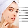 LUPO Comedones/Blackhead Remover Set – Stainless Steel Double Tool Kit – (Pack of 7)