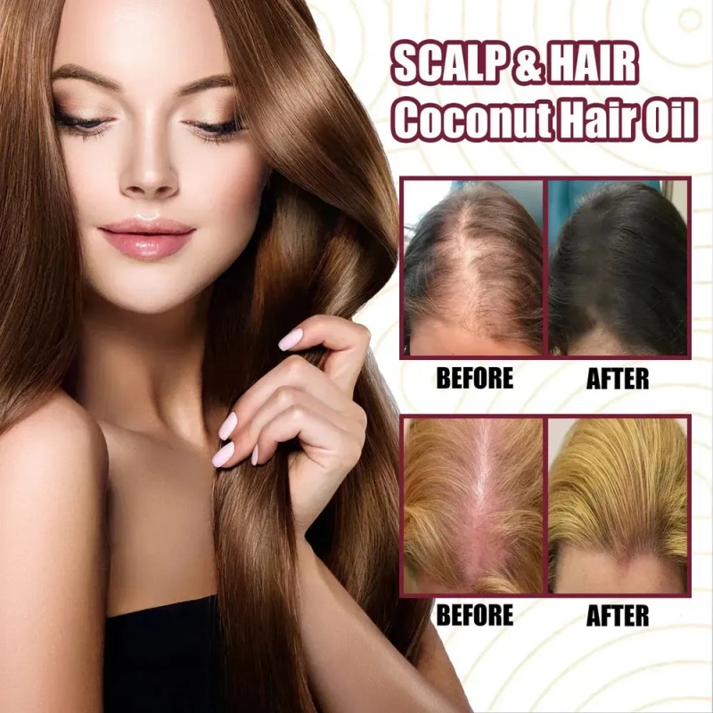 Aceite De Cebolla Para El Crecimiento Del Cabello 2pz ,w/