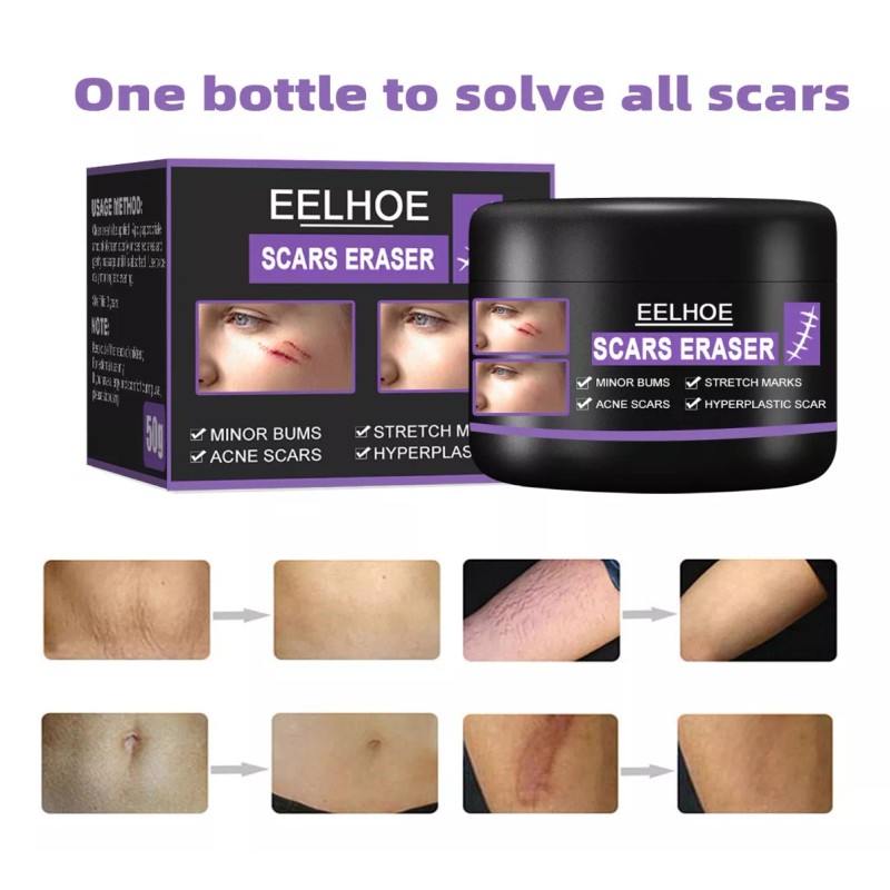 Eelhoe Ee Crema Scars Eraser, Reduce Marcas, Cicatrices, Manchas