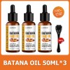 Aceite Batana Growth Fast Oil De Lewedo Naturals Para Cabell