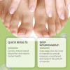 Líquido Para Hongos En Uñas - Cura Hongos Y Onicomicosis