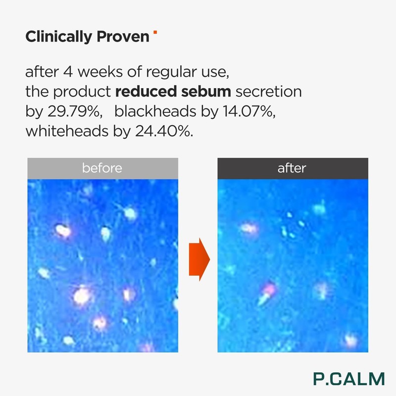 P.CALM Barrier Cycle Toner 16.9 fl oz (500 ml) /