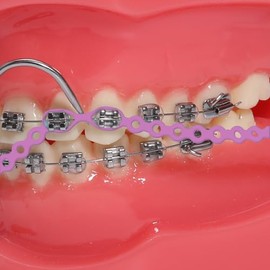 Colorido Dental Ortodoncia banda de goma elástica Power Chain para tirantes cortos largos continuos Tamaños Ortodoncia Tratamiento 1 pieza, Lavanda, Closed