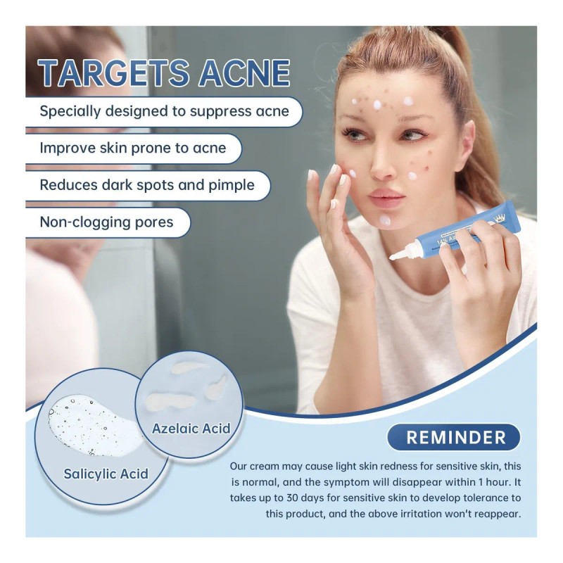 Ácido Azelaico Al 14% De Crema De Acné Para Alivio