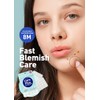 Hydrocolloid Acne Spot Patch - Clear Zits & Blemishes