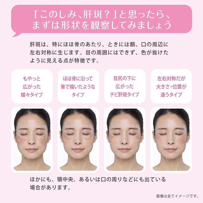 【第1類医薬品】トランシーノEX 60錠