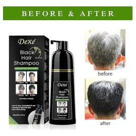 Shampoo Con Tinte Cubre Canas Dexe 400 Ml Color Negro                                                                                                 