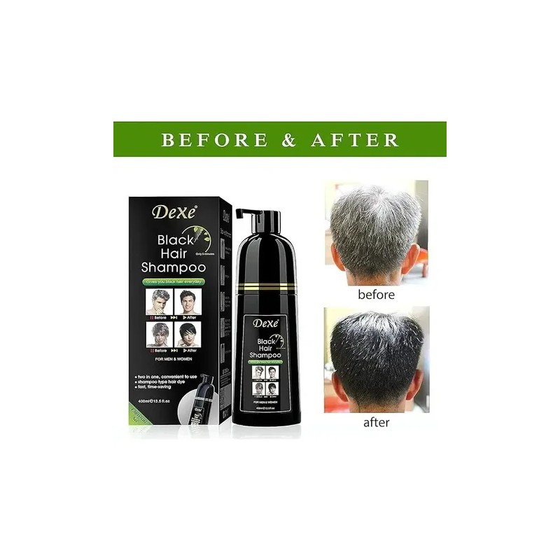 Shampoo Con Tinte Cubre Canas Dexe 400 Ml Color Negro