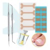 Universo en Linea Kit Corrección Uñas Encarnadas Pie Herramienta Pedicura